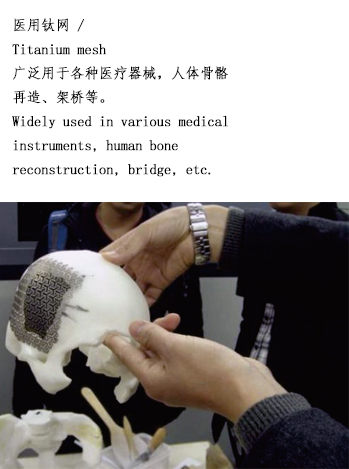 精密蚀刻